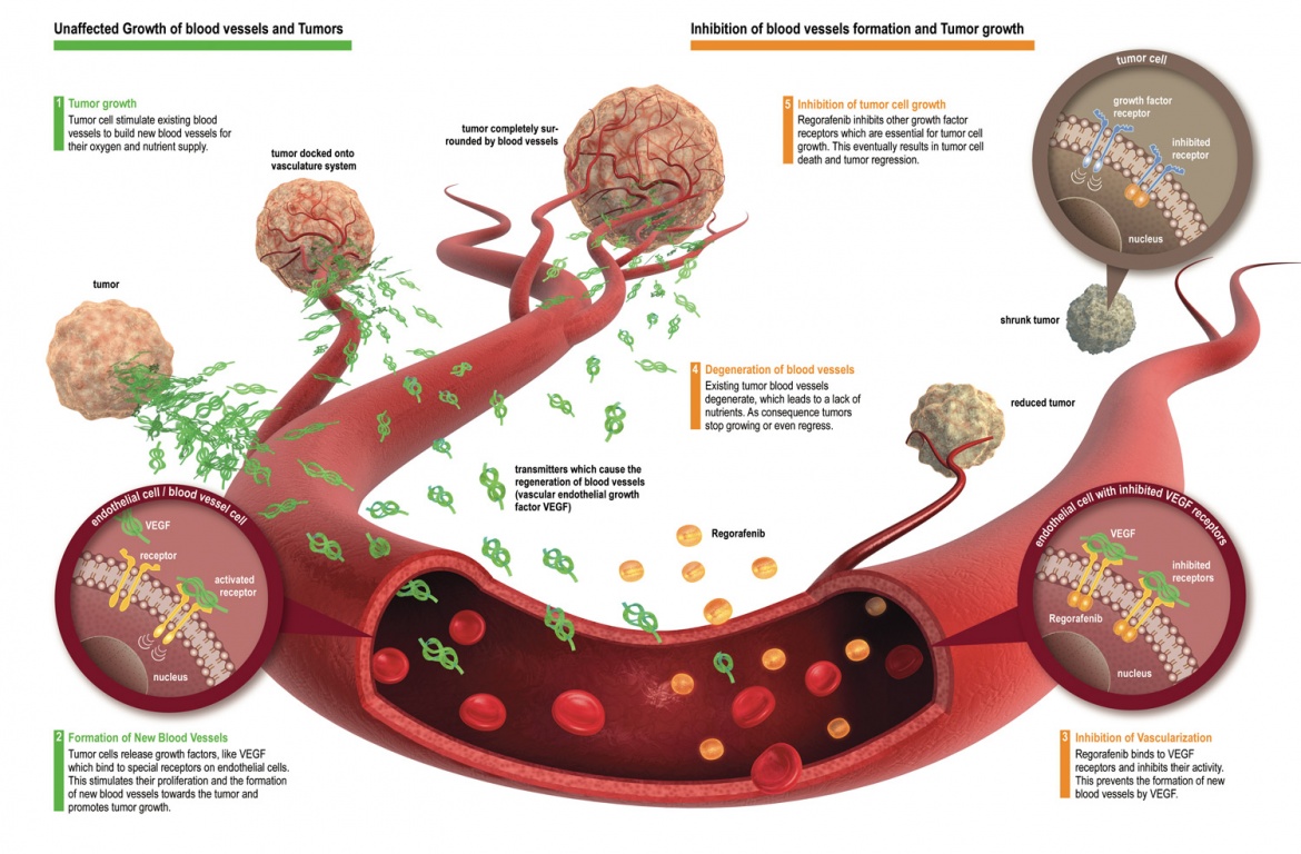 direkt_regorafenib_engl_large.jpg