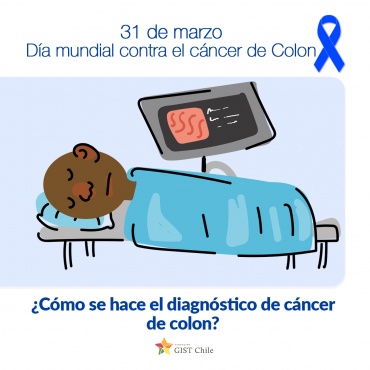 ¿Cómo se hace el diagnóstico de cáncer de colon?
